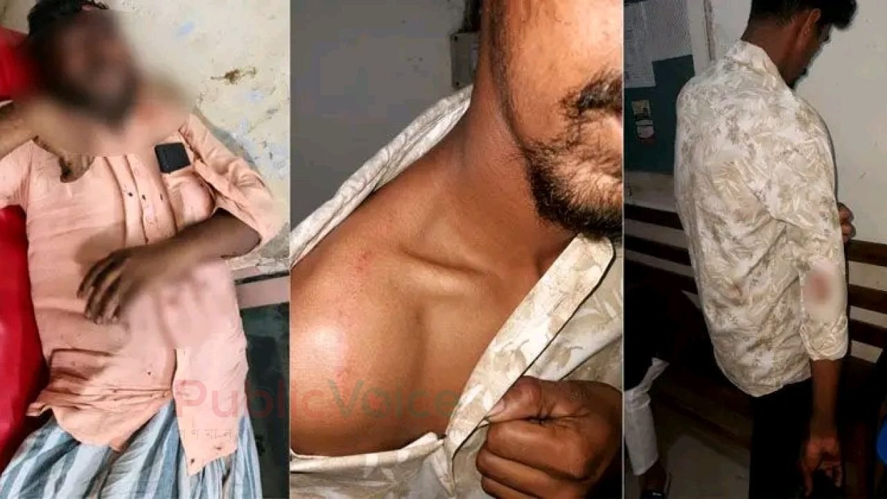 বিএনপি ছাএদল সংঘর্ষ অবৈধ ব্যাবসা নিয়ে