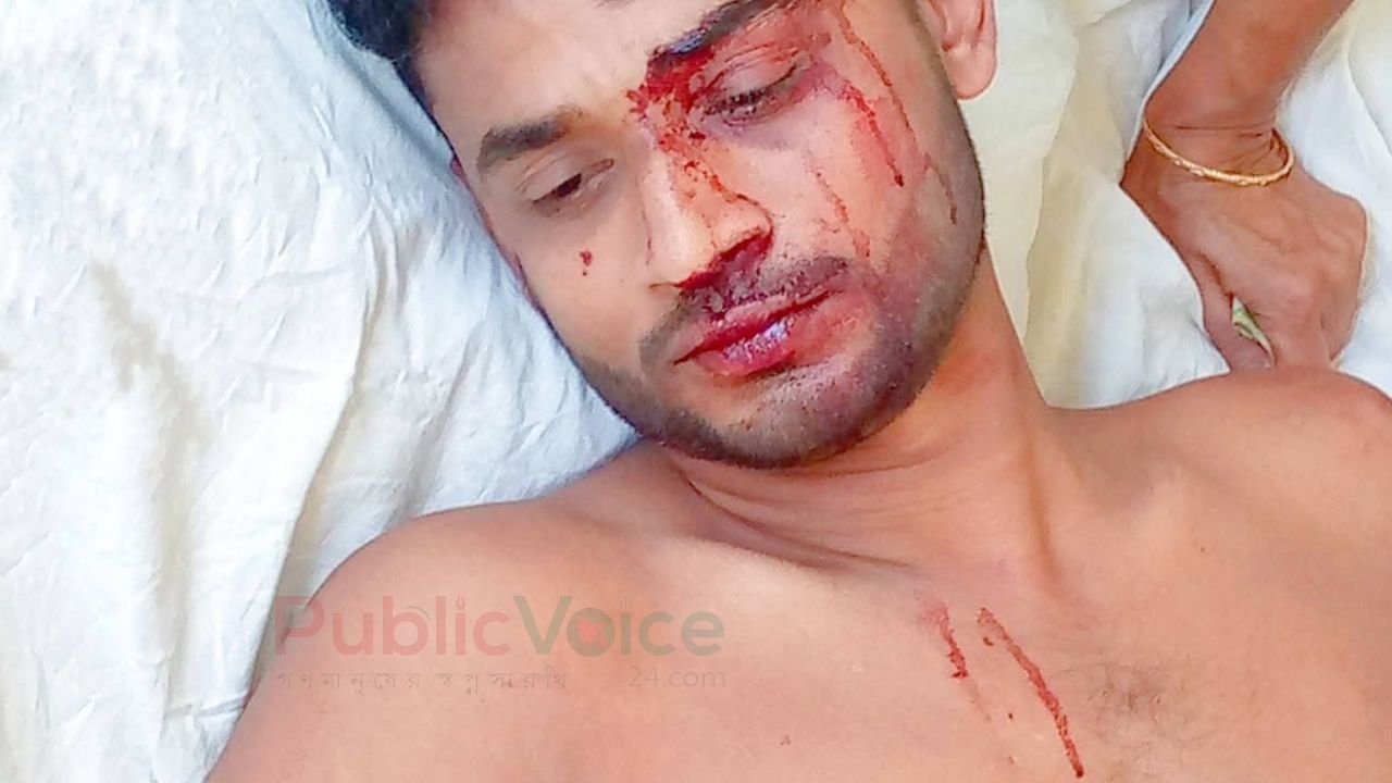 মাদকের বিরুদ্ধে প্রতিবাদ করায় যুবদল কর্মী রক্তাক্ত 