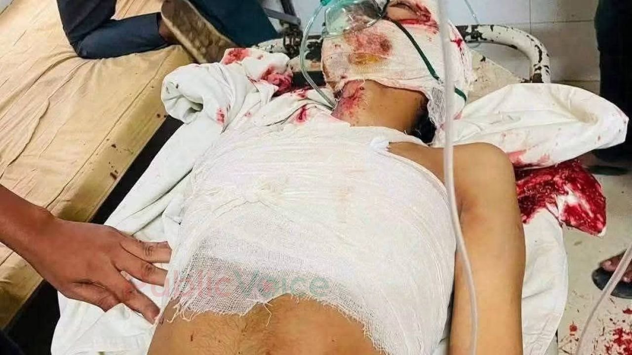 ২ ঘন্টায়ও অ্যাম্বুলেন্স পায়নি আরাফাত, অবহেলায় পড়েছিল শেরে বাংলায়   