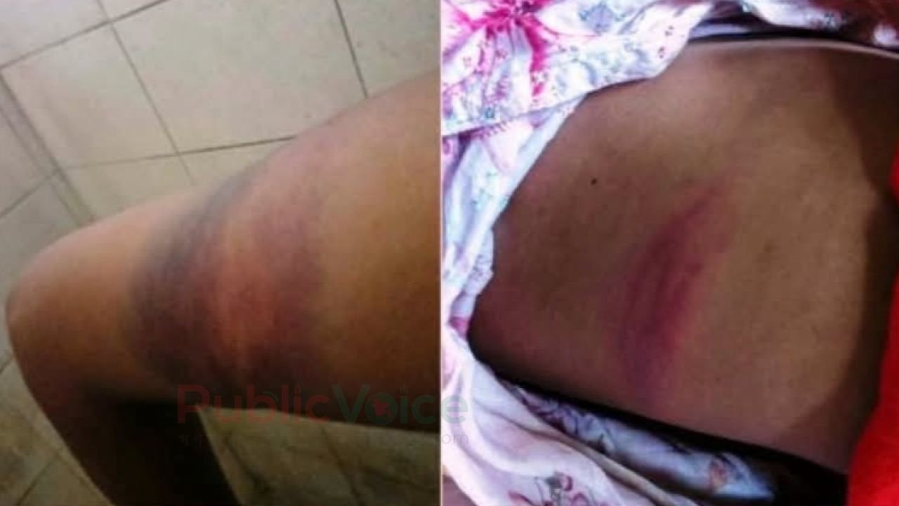 জুলাই শহীদের বোনের মামলায় গ্রেপ্তার নেই, ‘হুমকিতে’ পরিবার